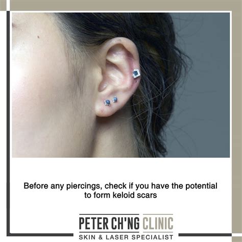 how to prevent piercing